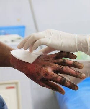 Revisión Quemaduras